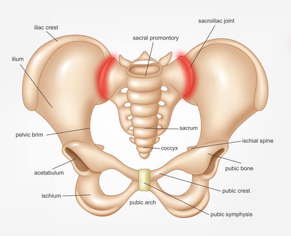 Sacroiliac Joint Pain Illustration - Image Courtesy of Spine One