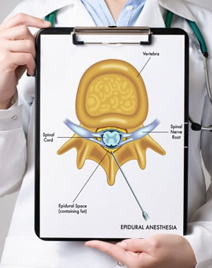 Epidural steroid injections in Denver