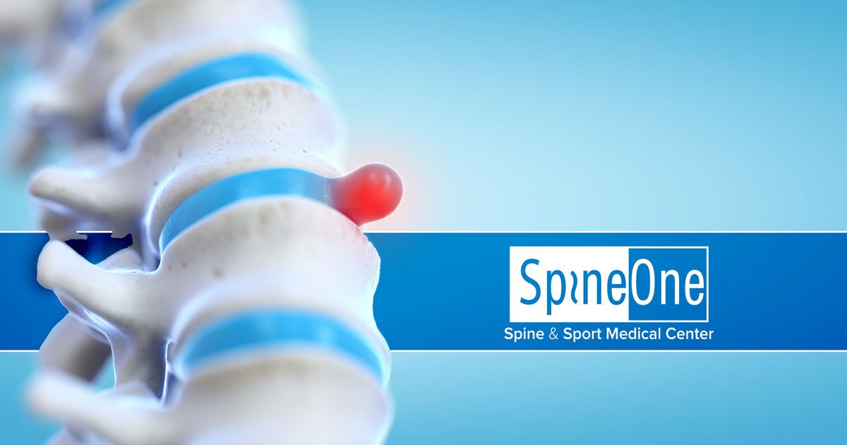 Herniated? Bulging? Slipped? Disc Degeneration Types Explained