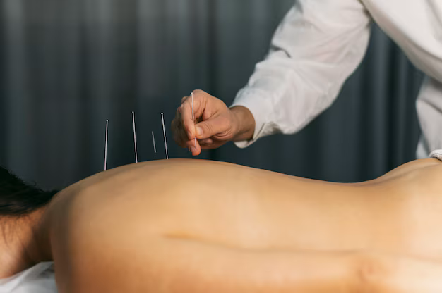 Provider performs acupuncture treatment on patient