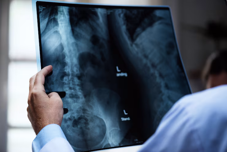 Doctor reviews spine X-rays