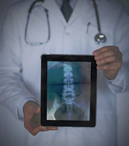 Doctor in white lab holds iPad with X-ray spine image