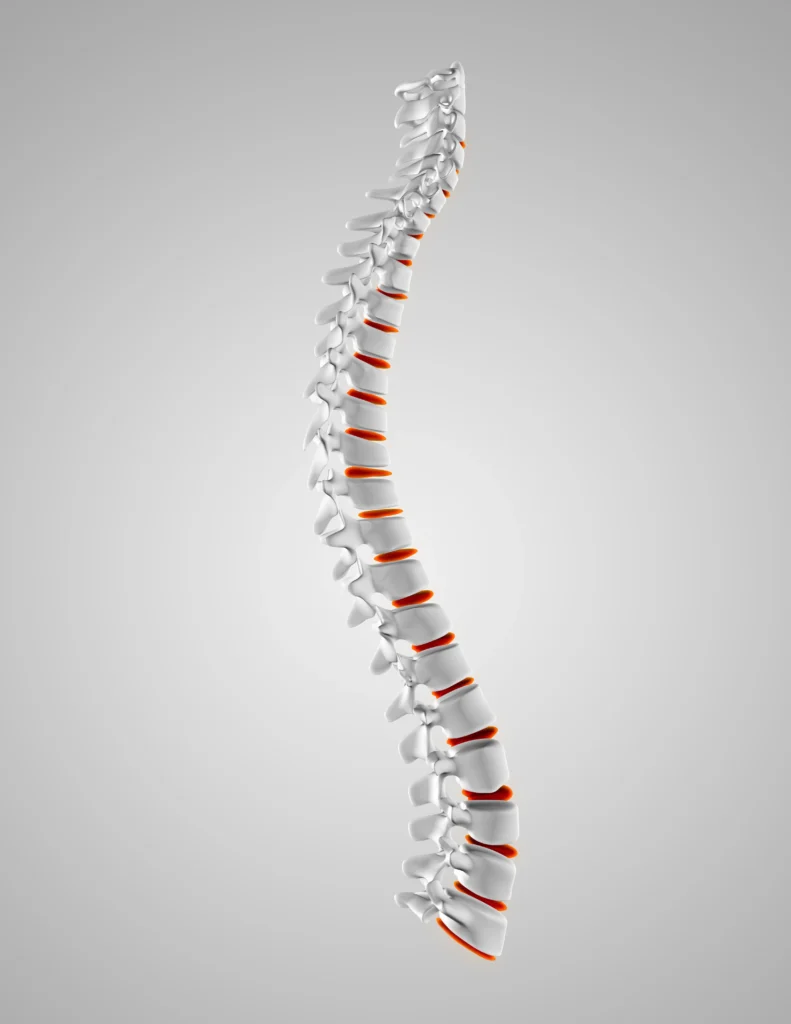 3D illustration of the human spine with highlighted discs.